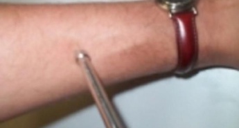 Finske raziskave o vplivu mobilnih telefonov na kožo