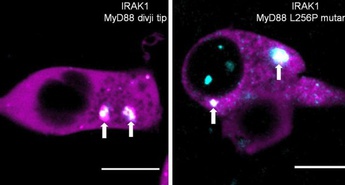 Odkritje molekulskega mehanizma razvoja limfoma