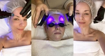 Tretmaj Hydrafacial ali hidrodermoabrazija