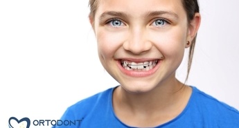 Kako brez čakalnih vrst do ortodonta za otroka?