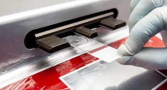 Rak ustnega žrela vse pogosteje povezan s HPV